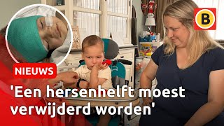 Download Lagu Milan heeft zeldzame hersenafwijking | Omroep Brabant MP3 Download Lagu Milan heeft zeldzame hersenafwijking | Omroep Brabant MP3
