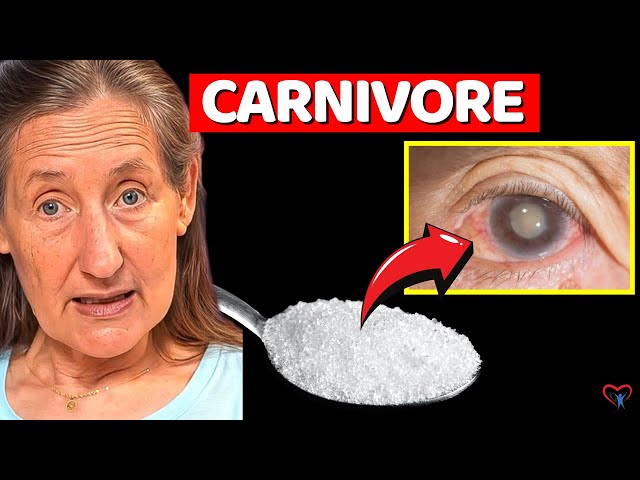 Carnivore Diet for Eye Health? (Better Vision, Cataracts, AMD, etc).