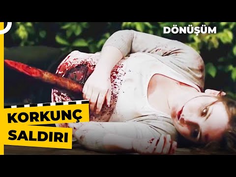 Kobaylar Genç Kadına Saldırdı | Dönüşüm