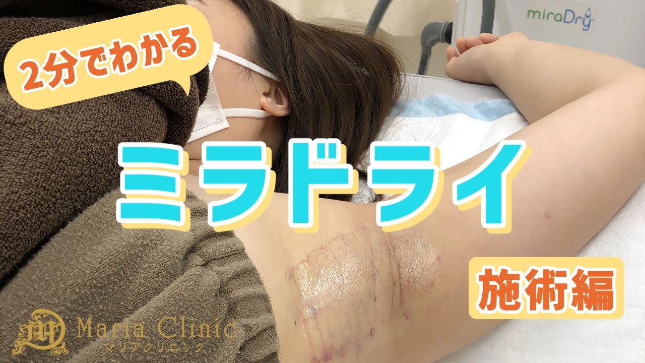 【リアル】汗腺を焼き切る！ミラドライ治療に潜入&インタビュー