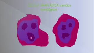 CLASE TEÓRICA 10 - TUMORES O NEOPLASIAS PARTE 1
