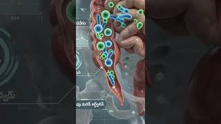 🩺 అపెండిక్స్ అంటే ఏమిటి?#Appendix #Appendicitis #HealthFactsTelugu #MedicalFacts #DigestiveSystem