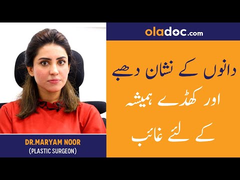 How To Get Rid Of Acne Scars Urdu Hindi - Danon Ke Nishan Khatam Karne Ki Tips - Remove Pimple Marks