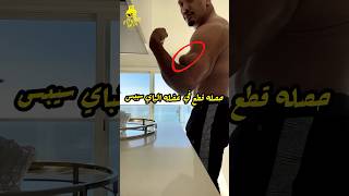 المجنون larrywheels حصله اصابة قطع في عضله الباي سيبس بسبب جنونة في الأوزان ?