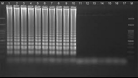 Loop mediated isothermal amplification reaction principle amination