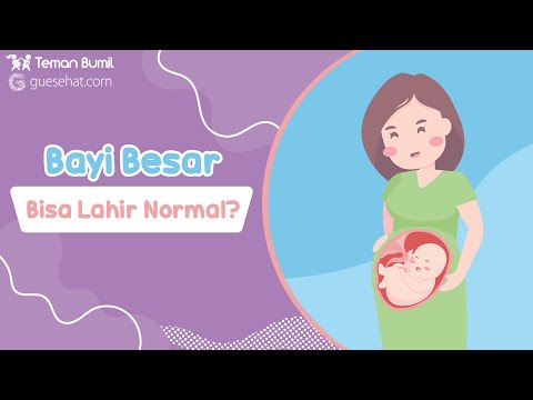 Bayi Besar Apakah Bisa Lahiran Normal?