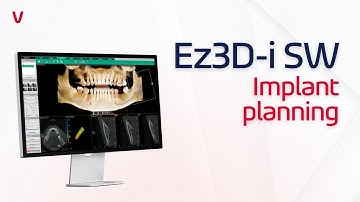 Ez3D-i SW | Implant Planning
