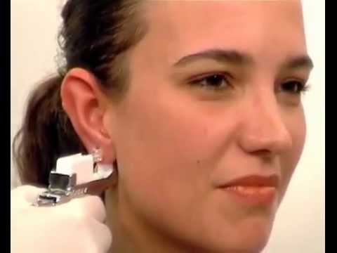 Что такое Studex System 75? - YouTube