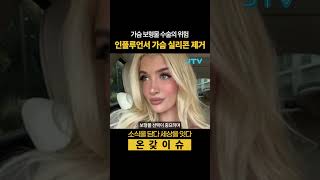 가슴 보형물 수술의 위험, 인플루언서 가슴 실리콘 제거 #가슴수술
