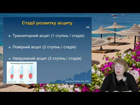 Як читати показники ЕХОКГ сімейному лікарю? Клінічний випадок. Нудченко А.О., Долженко М.М.