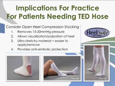 Practice Recommendations for Preventing Heel Pressure Ulcers