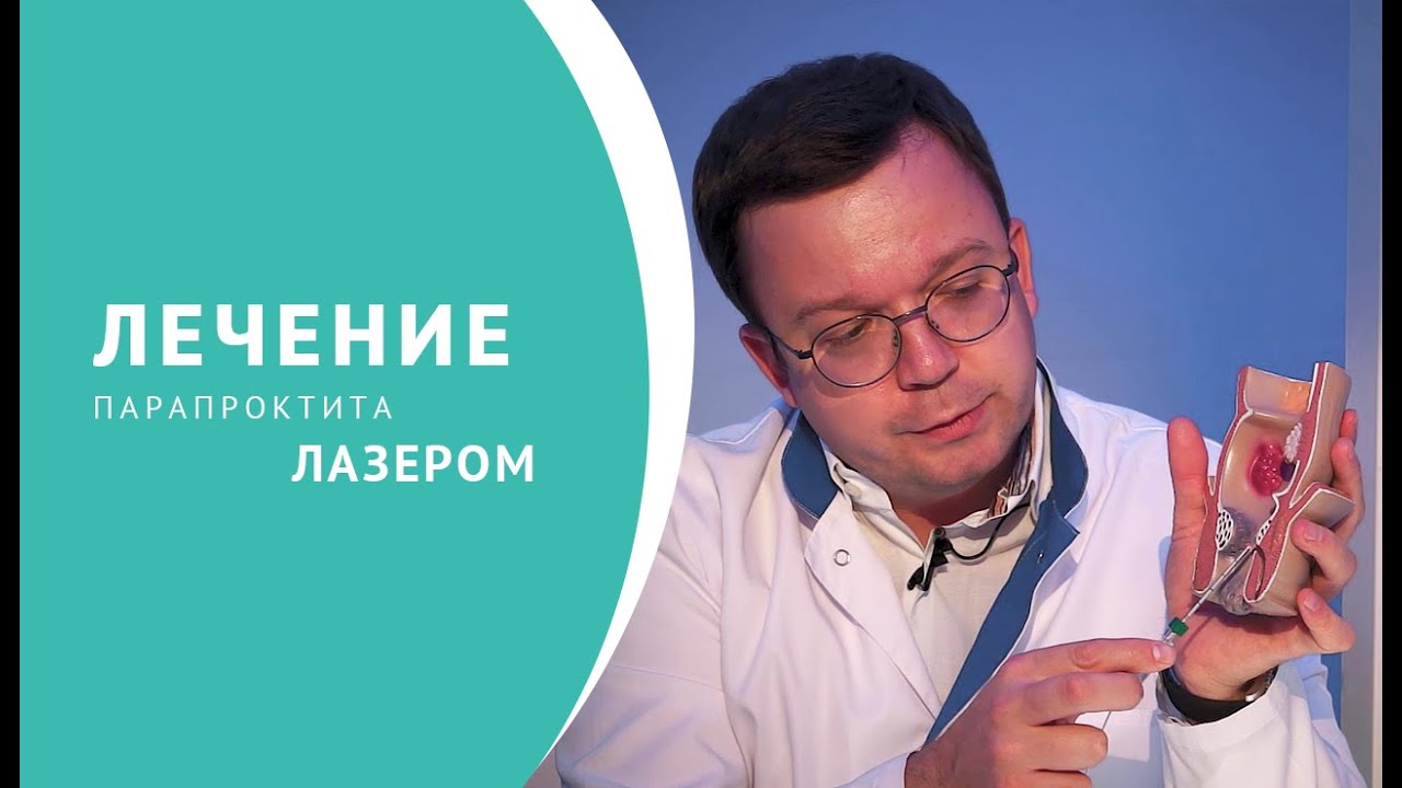 Лечение парапроктита лазером