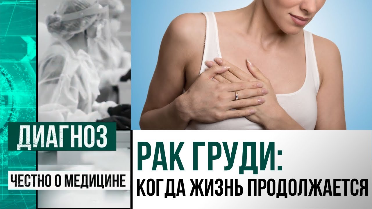 Рак – не приговор: истории женщин, которые живут с раком молочной железы | Диагноз - YouTube