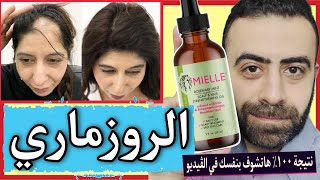 اكتشفت اقوي زيت روزماري ( اكليل الجبل ) في الوطن العربي للصلع و تساقط الشعر Mielle Rosemary Mint Oil