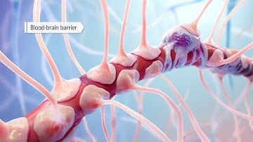 Focused ultrasound and microbubbles to overcome the blood-brain barrier for drug delivery