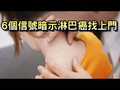 認識淋巴癌六大症狀