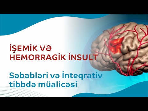 Video: Beynin hansı hissəsi insult zamanı zədələnir?
