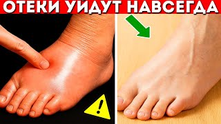 картинка: ОТЕКИ - КАК ИЗБАВИТЬСЯ НАВСЕГДА? ЗАСТОЙ ЛИМФЫ? НАСТОЯЩИЕ ПРИЧИНЫ ОТЕКОВ И ЧТО ДЕЛАТЬ?