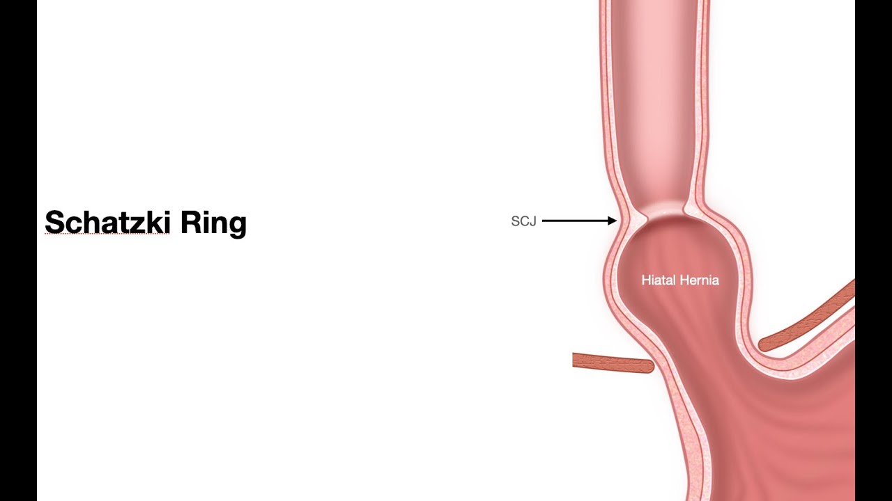 Airway Management with Point-of-Care-Ultrasound: A Breath of Fresh Air |  FCEP