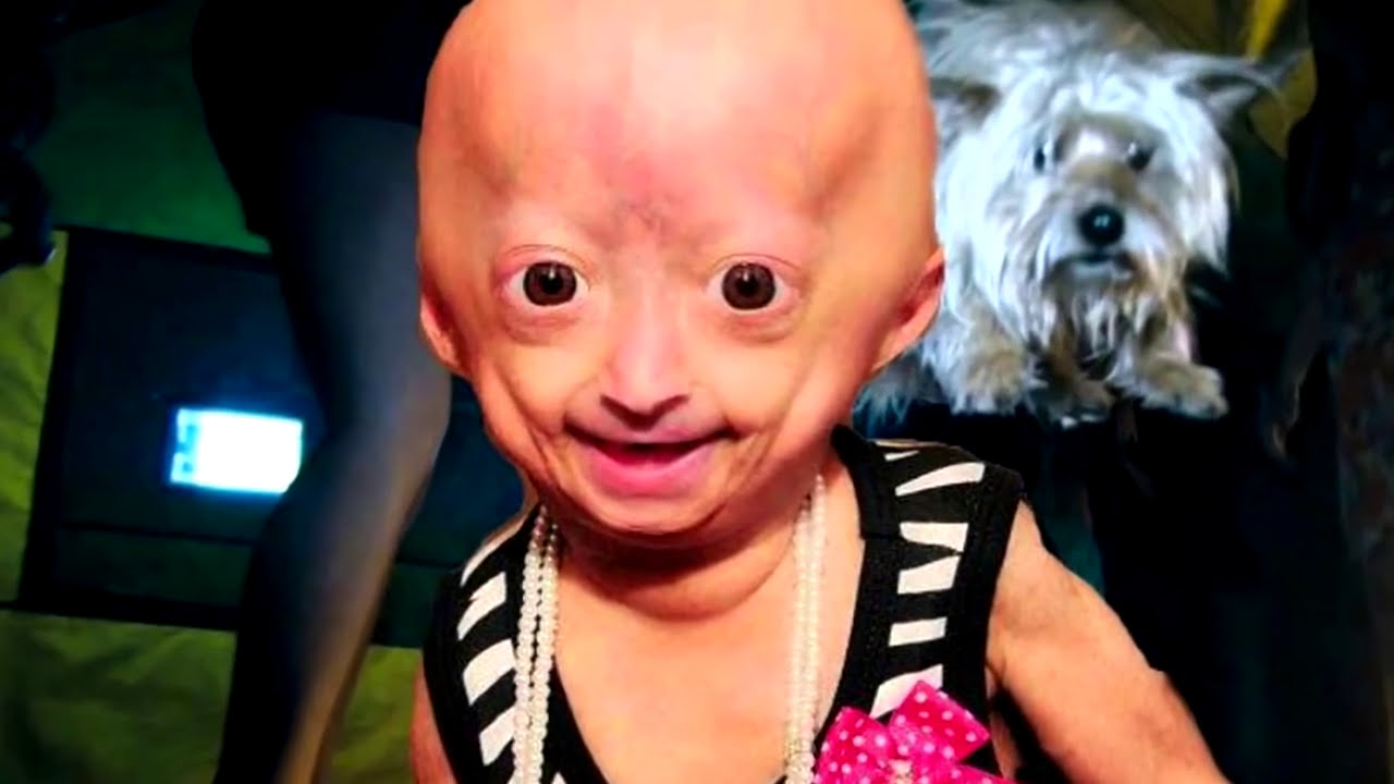 Unusual People With genetic mutations | REAL people with shocking