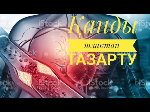 Бейне: Алюминийді қалай бояуға болады (суреттермен)