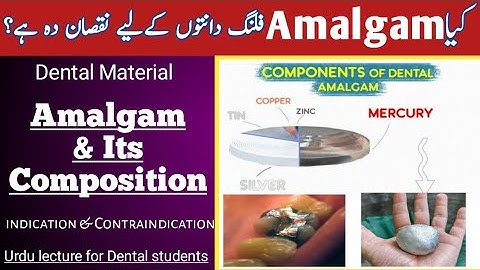 Dental Amalgam_Part#01// Urdu lecture for 3rd year students// Conservative Dentistry// IDS