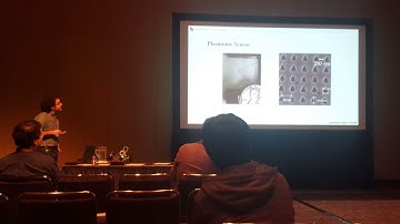Quantum Sensing Beyound the Shot-Noise Limite with Plasmonic Sensors