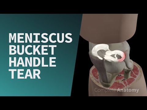 Video: Менискус синовиалдык суюктук бөлүп чыгарабы?