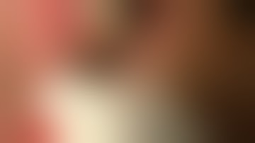 Physics Forceps Extraction of Upper Left Second Bicuspid from GoldenDent, Atraumatic Extraction