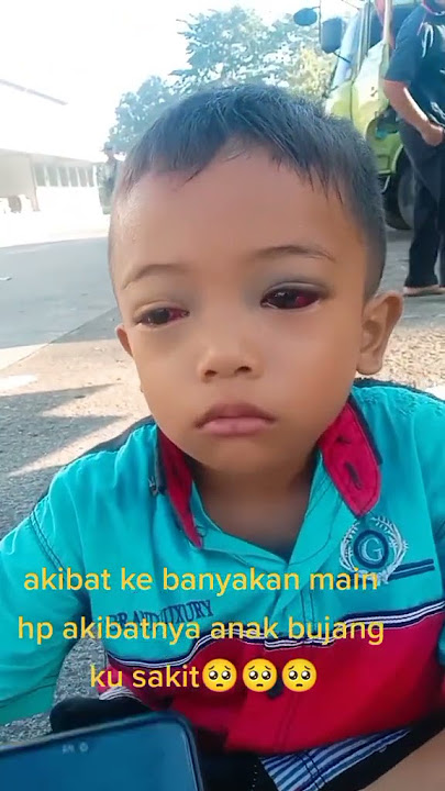 radiasi hp merusak saraf mata.