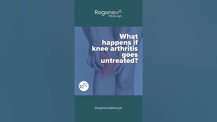 What Happens if Knee Arthritis Goes Untreated?