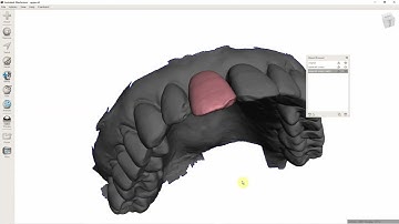 Tutorial Meshmixer Adhesion Bridge (Maryland bridge) design