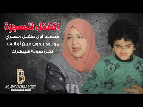 الطفل المعجزة محمد أول طفل مصري مولود بدون عين أو انف لكن صوته هيبهرك