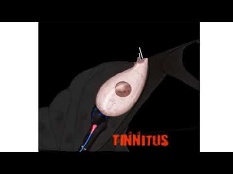 Video: Tinnitus - Syyt, Oireet Ja Hoito