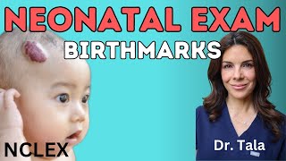 The 4 Most Common Birthmarks Neonatologist Reviews Nclex 8