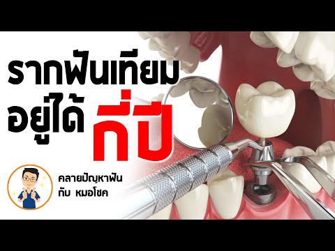 รากฟันเทียม อยู่ได้กี่ปี ? | คลายปัญหาฟัน กับ หมอโชค