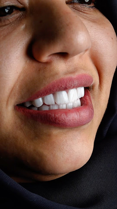 Change begins with a smile🤩 #dubai #dental #clinics #dubaidentist #doctordoctor #newsmile #smile