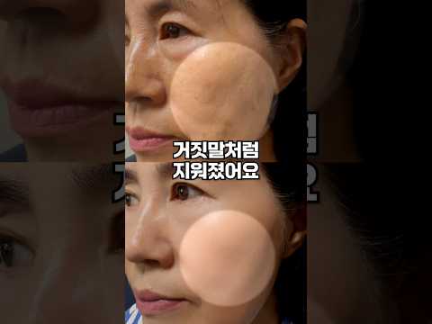 주름 기미잡티 피부톤 개선 만능 화장품 #화장품리뷰#기미잡티#잡티제거#주름고민#주름제거#팔자주름#눈가주름#주름크림#잡티크림#노화개선#기능성화장품#노화방지#미라클시크릿#퓨어라이트