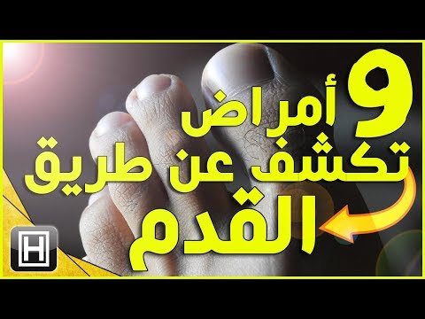 فيديو: فيليب الثاني المقدوني: معركة تشيرونيا