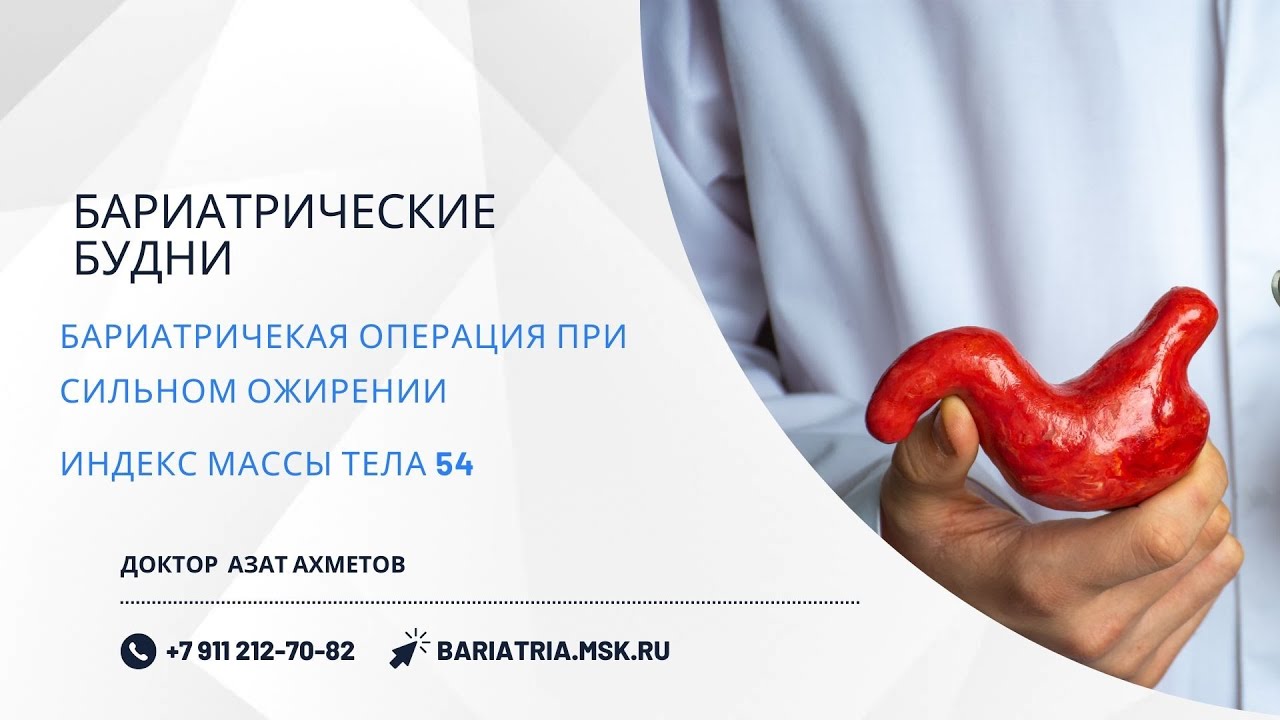 ИМТ 54. Бариатрическая операция при сильном ожирении - YouTube