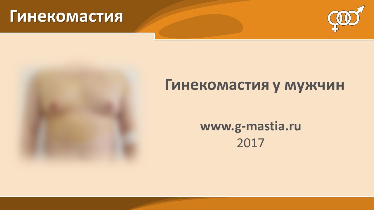 Липомастия у мужчин - YouTube