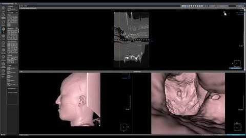 OnDemand3D Tool Tip - CPR(3D module)