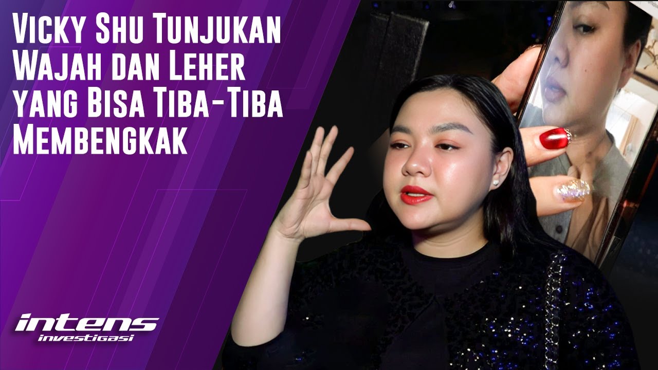Vicky Shu Tunjukan Leher Dan Wajah Yang Membengkak