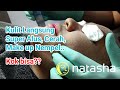 Microdermabrasi (Diamond Peeling) | On The Spot Natasha Skincare Sidoarjo