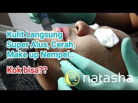 Microdermabrasi (Diamond Peeling) | On The Spot Natasha Skincare Sidoarjo