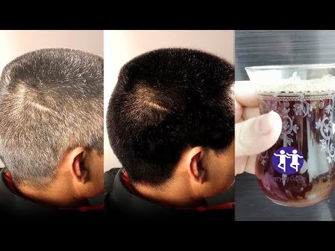 Say Goodbye To Your Grey Hair Just 1 ingredient  Get Rid of Your Grey Hair Permanently  white hair t