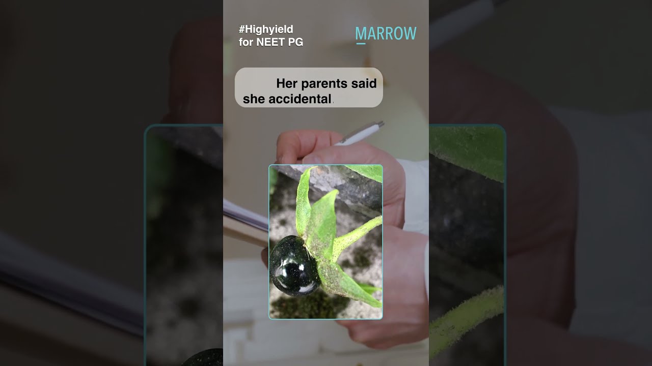 Name The Active Principle Of This Plant Poison Antidote Choice Preferred For Patient 