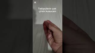 Takipçilerime Karışmayın..