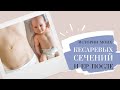 ЕР ПОСЛЕ КС | Мои истории родов 🌿