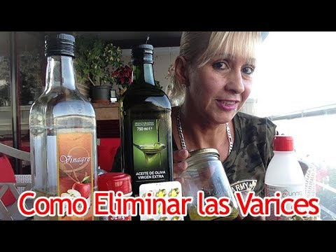 como quitar las varices con vinagre de manzana